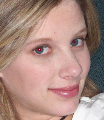 预防"红眼病 拍摄人物怎样预防红眼